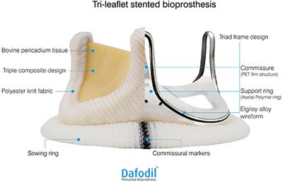 Three-year outcomes of surgical valve replacement with Dafodil™ pericardial bioprosthesis: Dafodil™-1 trial